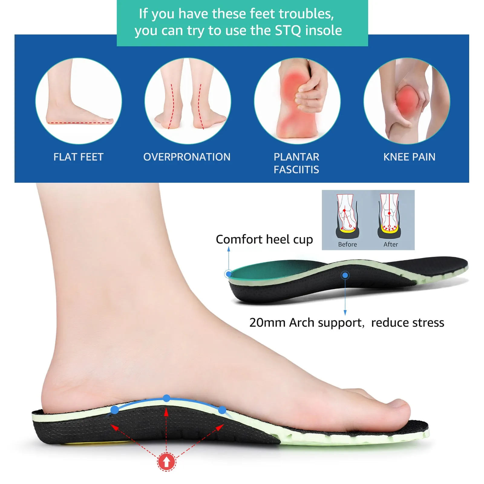 STQ Memory Foam Plantar Fasciitis Insoles