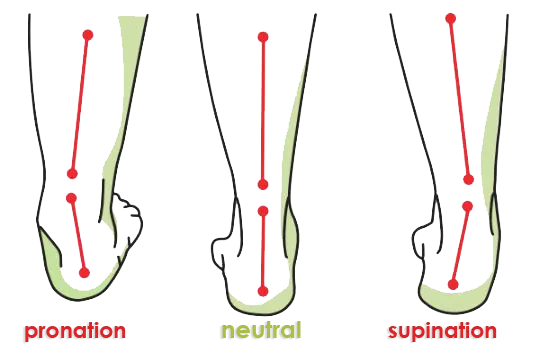 Wellness Ortho Insole - Plantar Fasciitis Foot Pain Relief